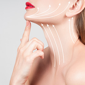 a woman showing off her neck lift with lines indicating the direction of the lift