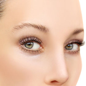 a woman looking to the camera after a tear trough treatment 